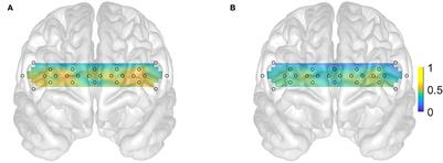 Screening for Alzheimer's disease using prefrontal resting-state functional near-infrared spectroscopy